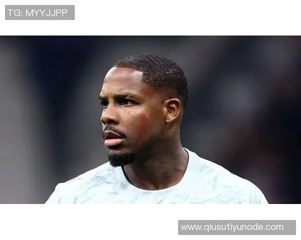 尤文图斯关注迈尼昂和切利克不再追逐格纳布里